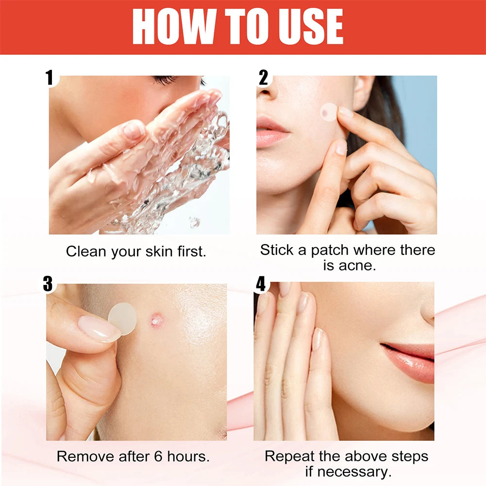 PIMPLE PATCH