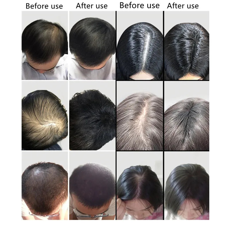 HAIR BUILDING FIBERS